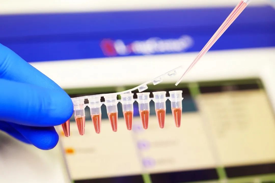 Kiel elekti PCR/qPCR konsumeblajn?